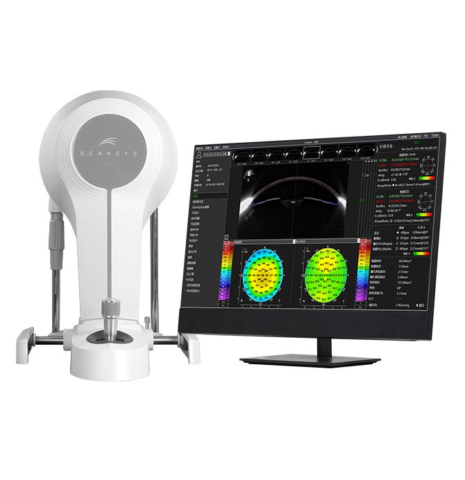 Scansys TA517 �n Segment Analizi