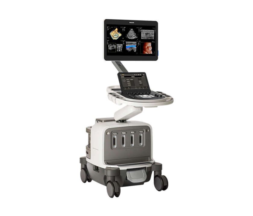 Philips EPIQ Elite