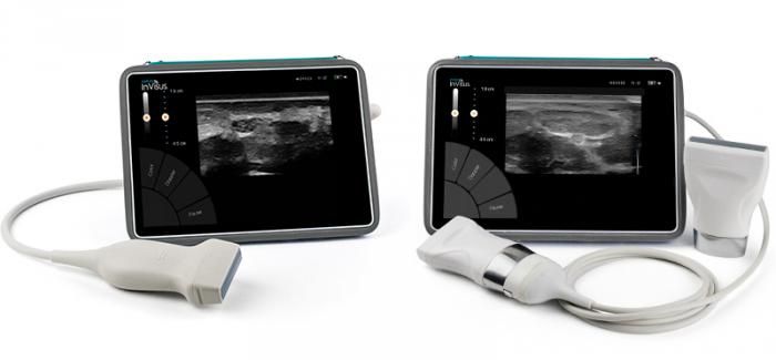 Natus InVisus Neuromuscular Ultrasound