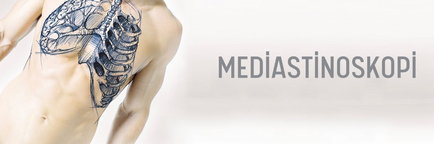 Mediastinoskopi