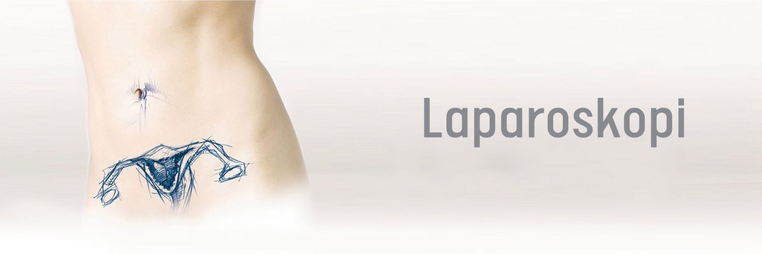 Laparoskopi